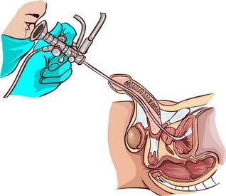 Ureteroskopijos procedūra